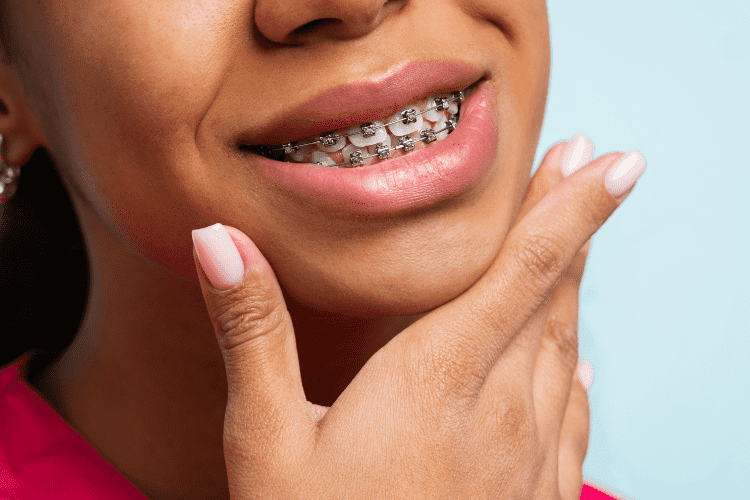 orthodontic braces underwood